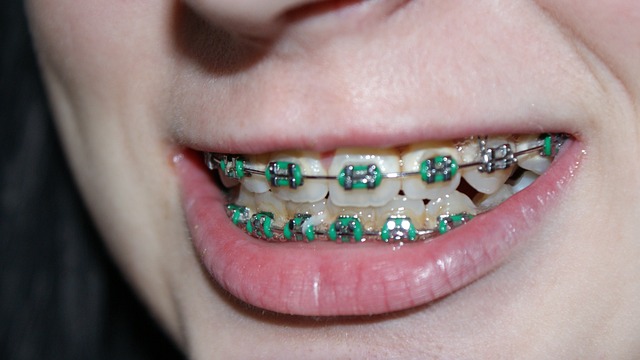 Medi-Cal braces adults