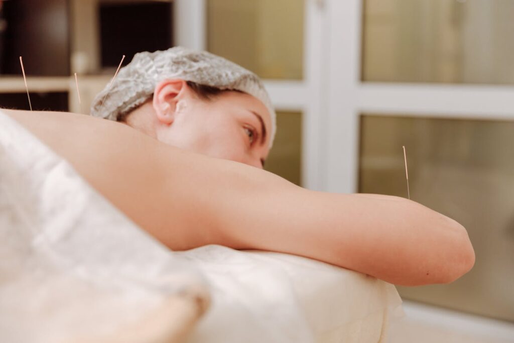 Is Acupuncture Covered by Insurance