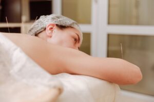 Is Acupuncture Covered by Insurance